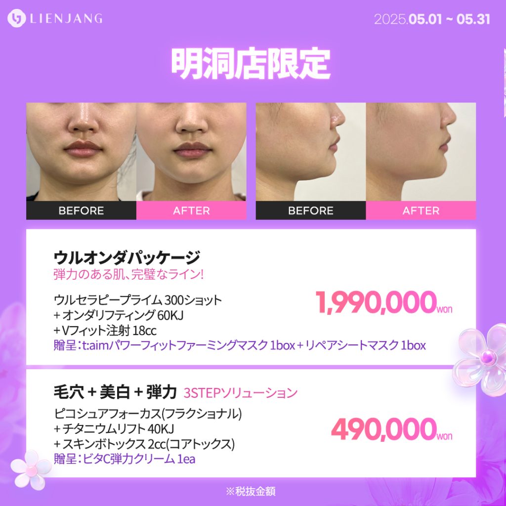 ウルオンダパッケージ 弾力のある肌、完璧なライン! ウルセラピープライム 300ショット + オンダリフティング 60KJ + Vフィット注射 18cc 贈呈：t:aimパワーフィットファーミングマスク 1box + リペアシートマスク 1box 毛穴 + 美白 + 弾力 3STEPソリューション ピコシュアフォーカス(フラクショナル) + チタニウムリフト 40KJ + スキンボトックス 2cc(コアトックス) 贈呈：ビタC弾力クリーム 1ea