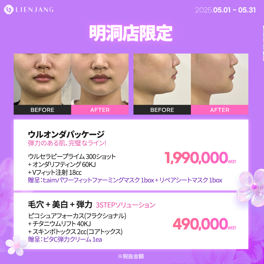 ウルオンダパッケージ 弾力のある肌、完璧なライン! ウルセラピープライム 300ショット + オンダリフティング 60KJ + Vフィット注射 18cc 贈呈：t:aimパワーフィットファーミングマスク 1box + リペアシートマスク 1box 毛穴 + 美白 + 弾力 3STEPソリューション ピコシュアフォーカス(フラクショナル) + チタニウムリフト 40KJ + スキンボトックス 2cc(コアトックス) 贈呈：ビタC弾力クリーム 1ea