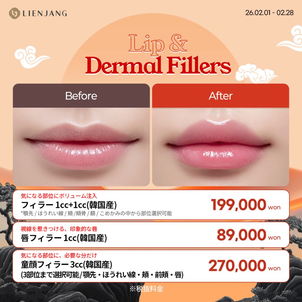 #韓国美容 #韓国皮膚科 #カンナム皮膚科 #韓国整形 #渡韓美容 #渡韓整形 #韓国旅行 #美肌 #美肌ケア #リフトアップ #アンチエイジング #ウルセラ #ウルセラピープライム #サーマクール #ポテンツァ #リジュラン #ジュベルック #エクソソーム #インモード #シュリンク #フィラー #唇フィラー #ボトックス #ララピール #水光肌 #オンダリフト #ソフウェーブ #リエンジャン #リエンジャン江南 #KBEAUTY