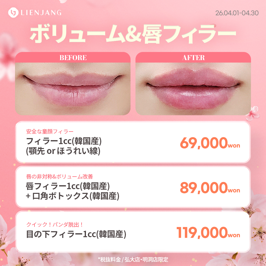 #韓国美容 #韓国皮膚科 #皮膚科 #韓国整形 #渡韓美容 #渡韓整形 #韓国旅行 #美肌 #美肌ケア #リフトアップ #アンチエイジング #ウルセラ #ウルセラピープライム #サーマクール #ポテンツァ #リジュラン #ジュベルック #エクソソーム #インモード #シュリンク #フィラー #唇フィラー #ボトックス #ララピール #水光肌 #オンダリフト #ソフウェーブ #リエンジャン #リエンジャン #KBEAUTY