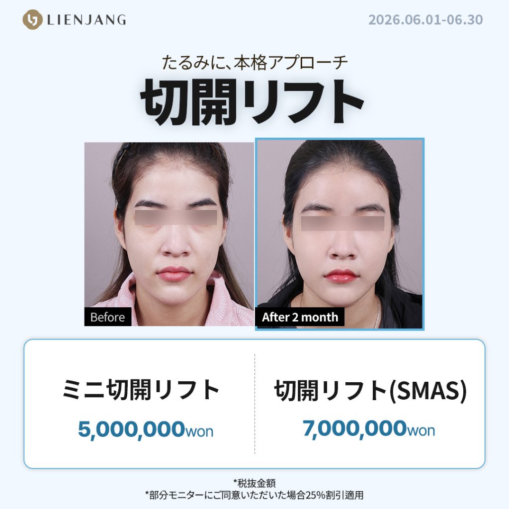リエンジャン江南本店, リエンジャン江南, 江南美容整形, 韓国皮膚科, 韓国美容外科, 韓国肌管理, カンナム美容クリニック, リエンジャン 予約, リエンジャン 口コミ, 美容整形外科 おすすめ ,鼻整形, 目整形, リフティング, ボディ, ボディ脂肪吸引